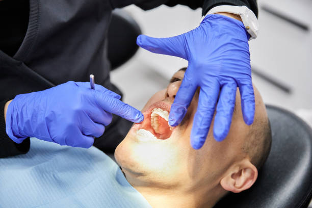 Best Emergency Dental Extractions in Hanford, CA